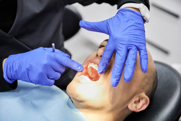 Best Emergency Treatment for Toothache in Mercedes, TX